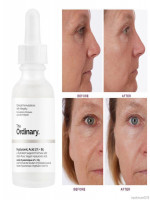 The Ordinary Hyaluronic Acid 2% + B5 - 30 ml