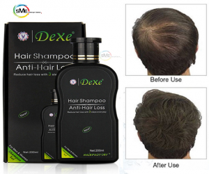 Dexe Anti Hair Loss Shampoo - Price in Bangladesh