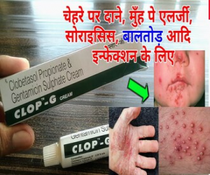 Clop - G Cream-30g - Price in Bangladesh
