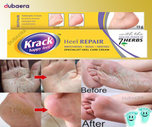 Krack Cream 15 gm - Price in Bangladesh