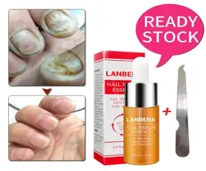 LANBENA Nail Repair Essence Serum